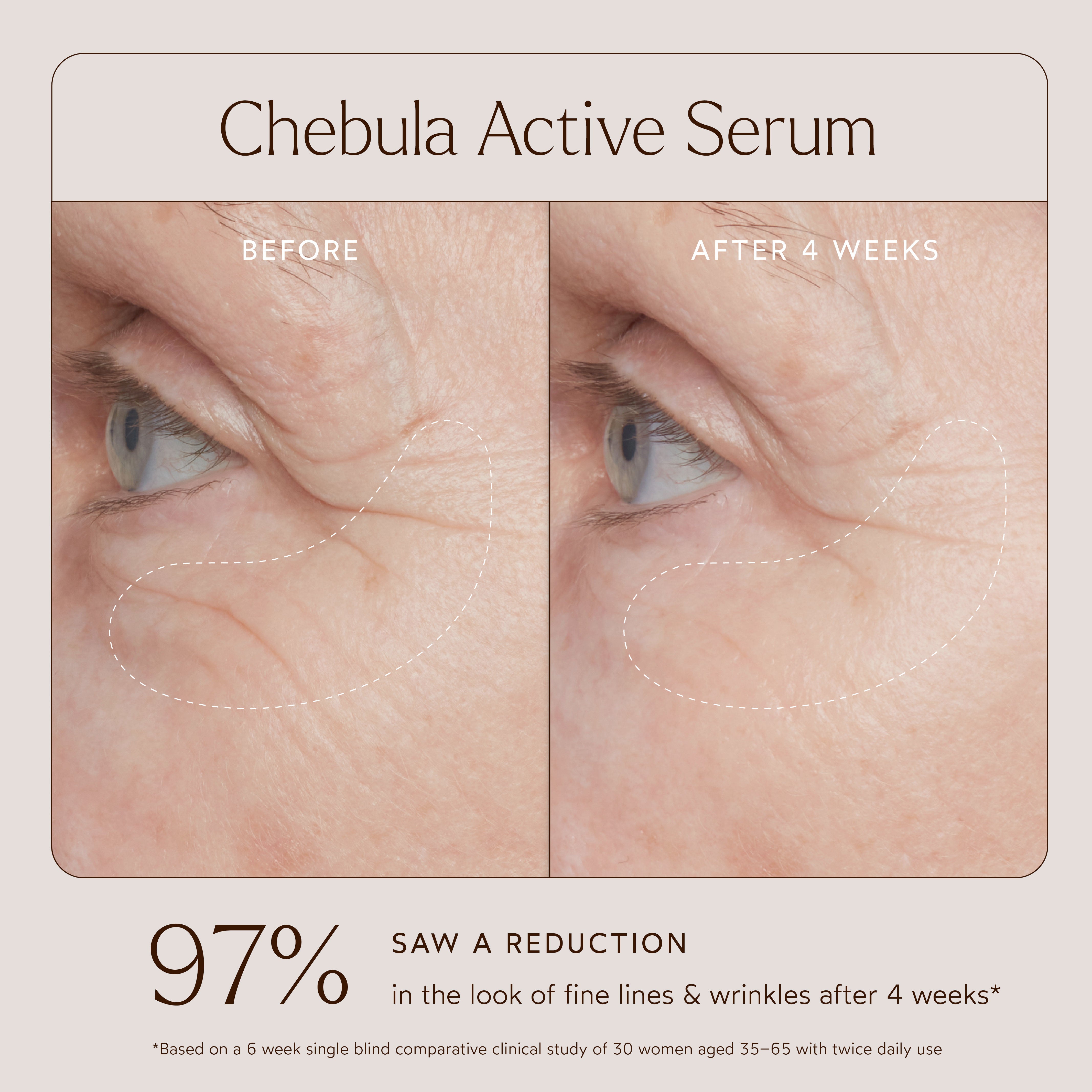 Chebula Active Serum